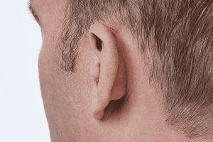 Oticon Siya 1 Itc Kulak İçi İşitme Cihazı
