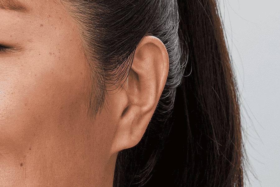 Oticon Zircon 1 Mini Rite R Şarj Edilebilir Mini Kulak Arkası İşitme Cihazı